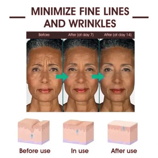 👩‍⚕️🔥Last Day Promotion 𝟕𝟎%𝐎𝐅𝐅 - SkinFirming Rejuvenating Serum🔥