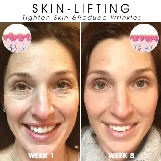🔥👩‍⚕️Last Day Promotion 𝟕𝟎%𝐎𝐅𝐅 - SkinFirming Rejuvenating Serum🔥
