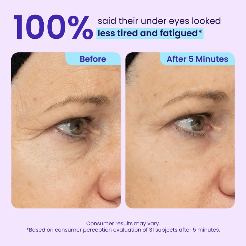 Final 3 Hours: 60%OFF🔥 Instant Lift Eye Gel for Puffiness, Bags & Dark Circles