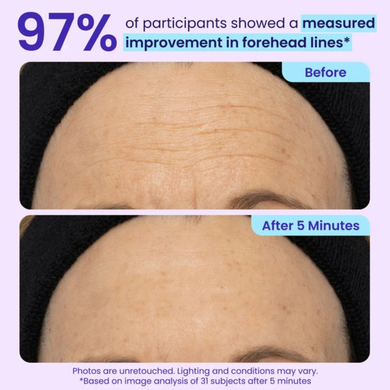 Final 3 Hours: 60%OFF🔥 Instant Lift Eye Gel for Puffiness, Bags & Dark Circles