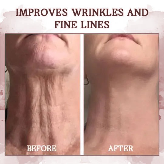👩‍⚕️🔥Last Day Promotion 𝟕𝟎%𝐎𝐅𝐅 - SkinFirming Rejuvenating Serum🔥