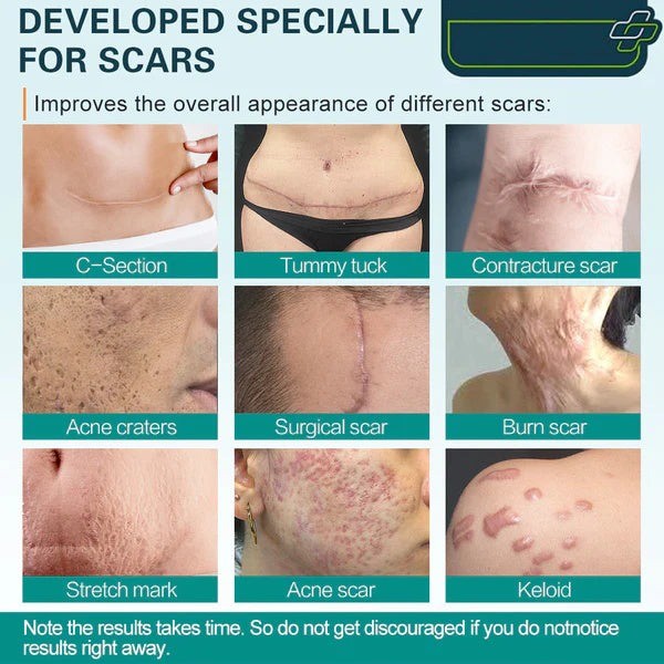 Scar Rejuvenation Spray