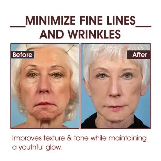 👩‍⚕️🔥Last Day Promotion 𝟕𝟎%𝐎𝐅𝐅 - SkinFirming Rejuvenating Serum🔥