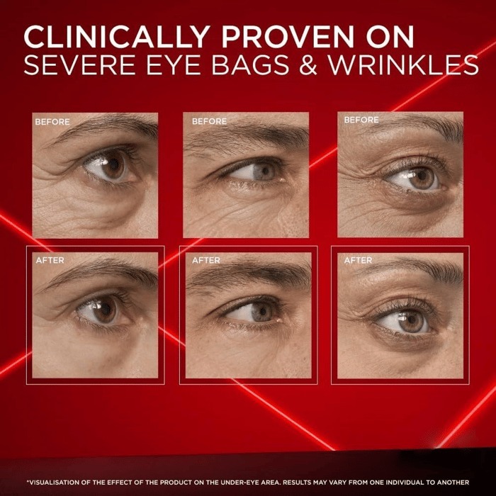 🔥49% OFF This Week Promotions-✨Eye Bag Instant Eraser, Tightens, Firms, & Blurs Wrinkles