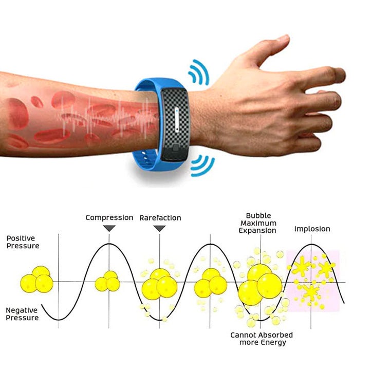 (🔥LAST DAY 70% OFF) Histone™ Matteo Ultrasonic Body Shape Wristband Pro 🔥
