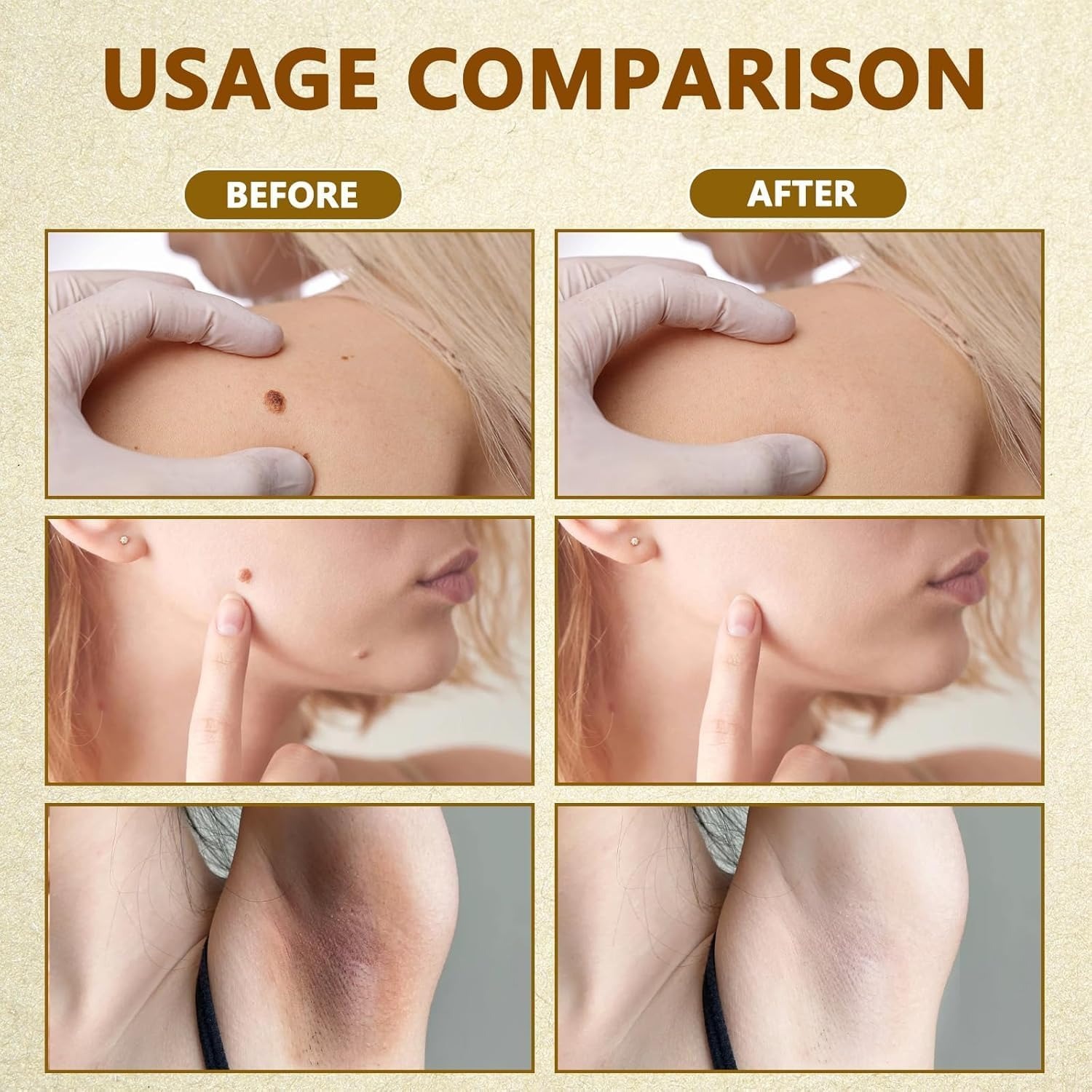 BeeRx™ Bee Venom Cream – The Natural Secret to Ageless, Healthy Skin